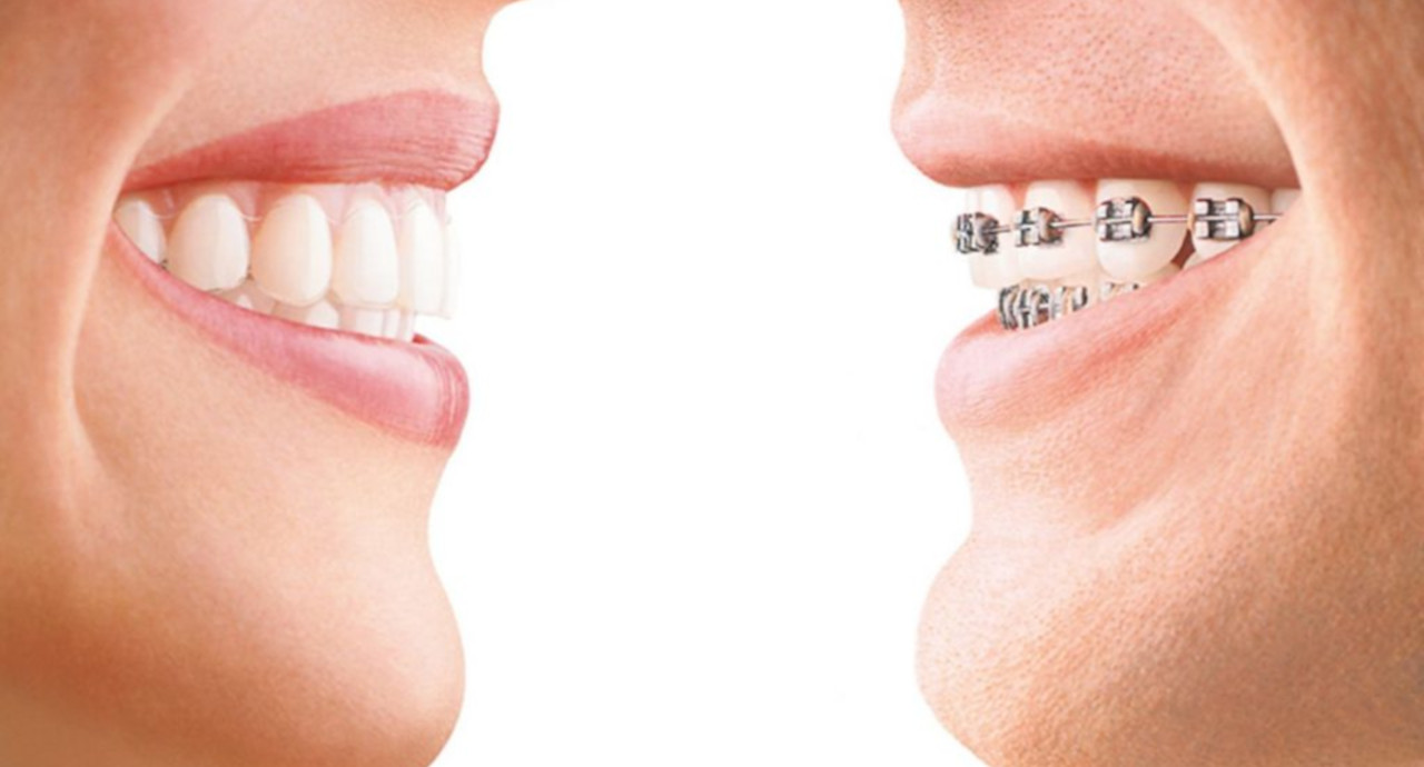 Evolution of Orthodontics